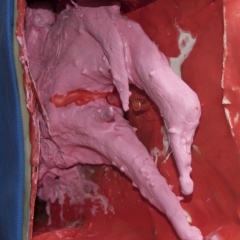 detail-wounded (3 of n)